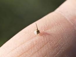 How to Remove a Wasp Stinger Safely