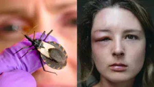 kissing bug removal safety