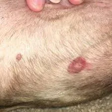 Bed Bug Bites on Pets