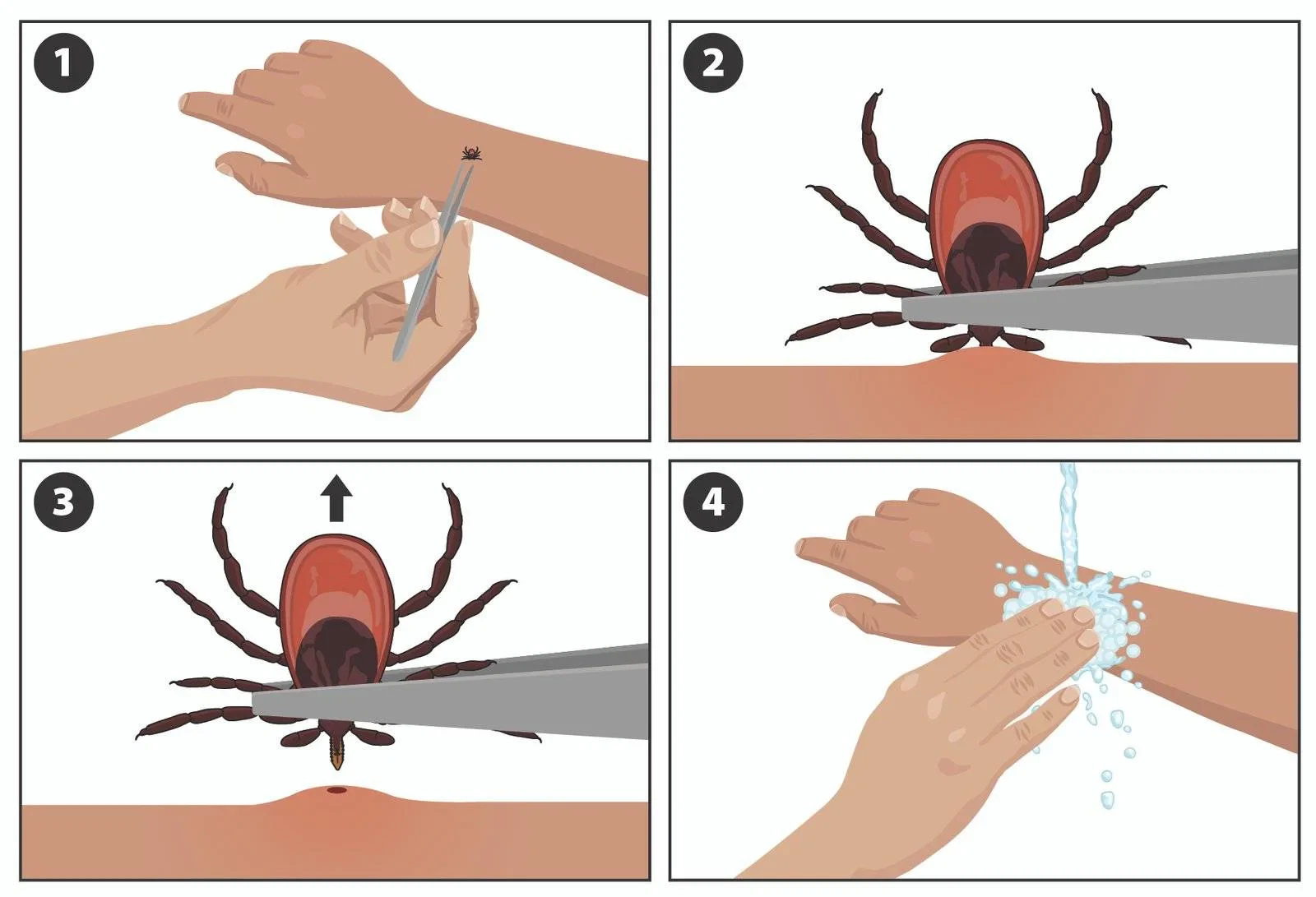 How to Remove Ticks Safely