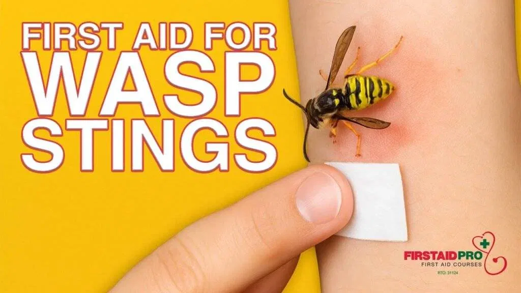 How to Treat a Wasp Sting