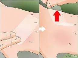 Post Sting Care Guide