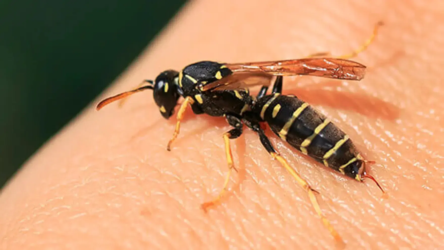 Remove Wasp Sting Safely