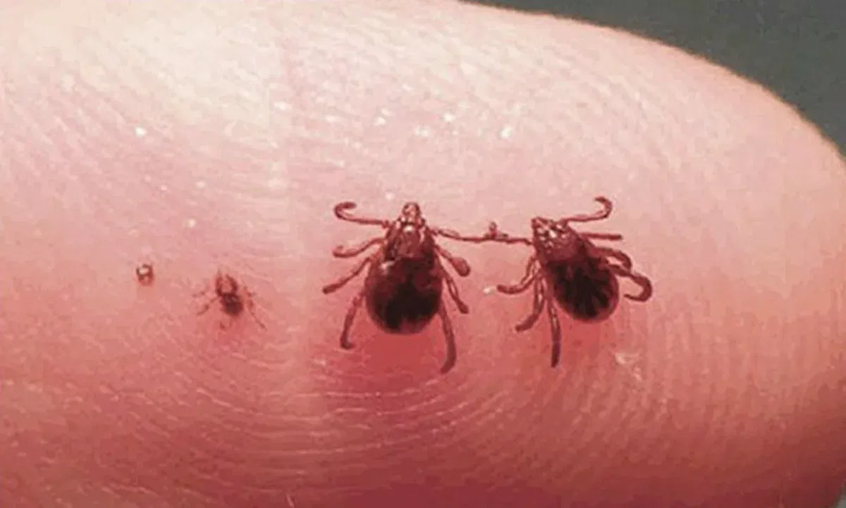 Ticks in Dogs and Human Transfer