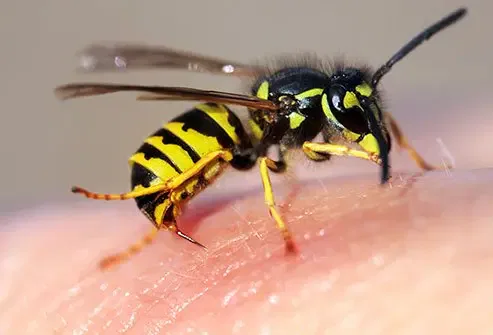 How Long Does Wasp Sting Pain Last