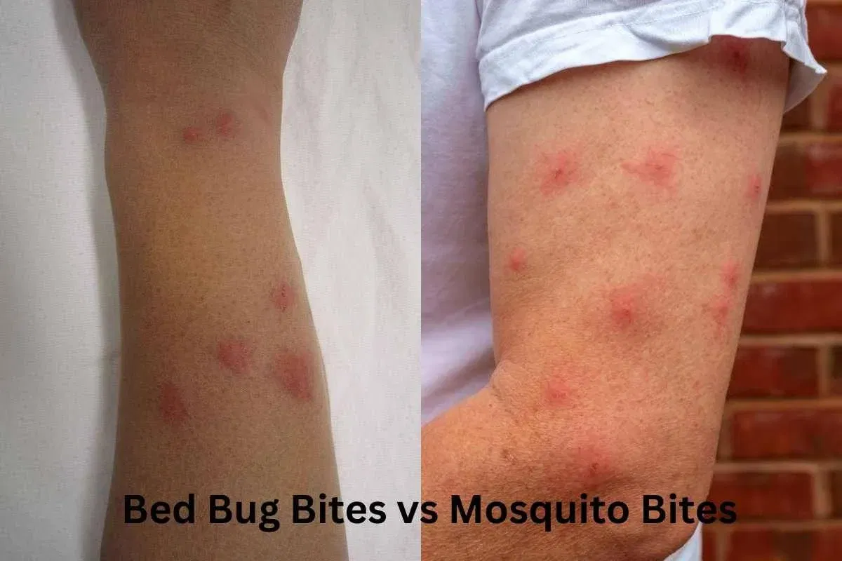 How to Identify Bed Bug Bites vs Mosquito Bites
