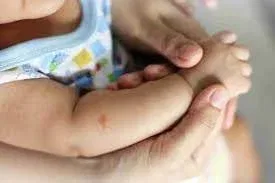 Mosquito Bites on Babies