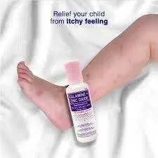 Calamine Lotion for Bug Bites