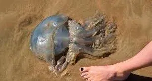 Should You Pee on a Jellyfish Sting