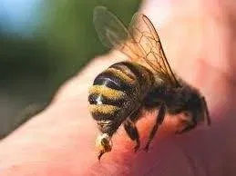 Signs of Infected Bee Sting