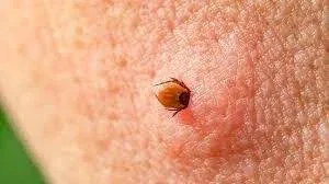 Bites Inside the House But No Signs of Pests