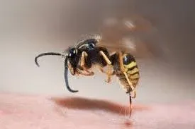 What to Do After Wasp Sting