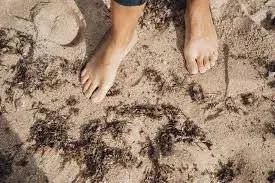 sand flea bites contagious in kids 