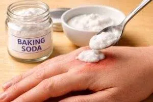 Checklist of anaphylaxis symptoms for emergency sting recognition.