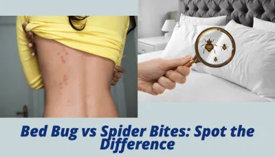 Bed Bug vs Spider Bites