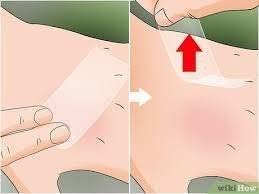 Post Sting Care Guide