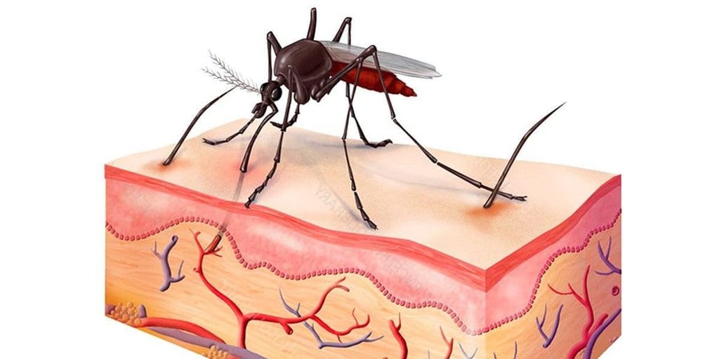 Why Do Mosquito Bites Itch